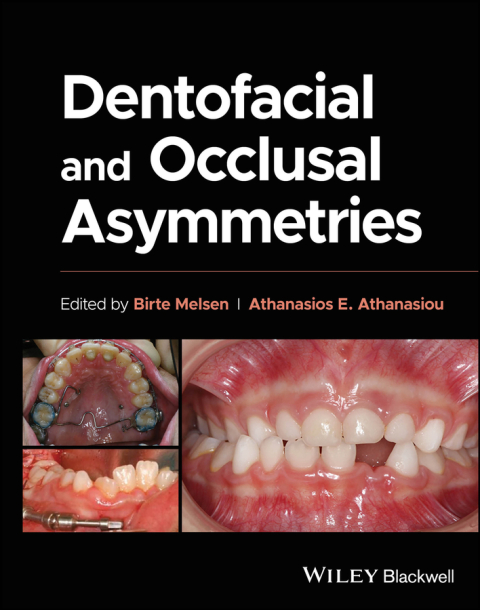 Cover image for book Dentofacial and Occlusal Asymmetries