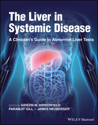 The Liver in Systemic Disease