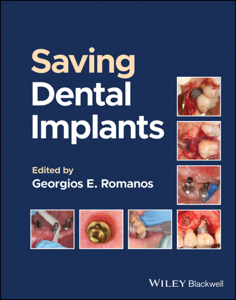 Cover image for book Saving Dental Implants