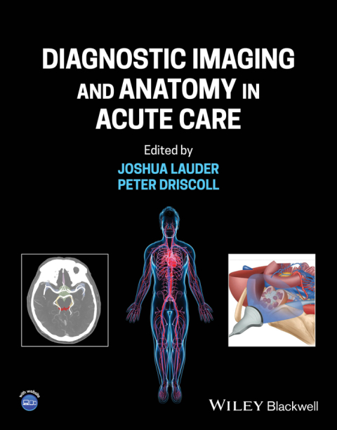 Cover image for book Diagnostic Imaging and Anatomy in Acute Care