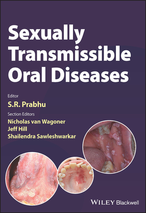 Cover image for book Sexually Transmissible Oral Diseases