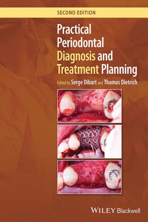 Cover image for book Practical Periodontal Diagnosis and Treatment Planning