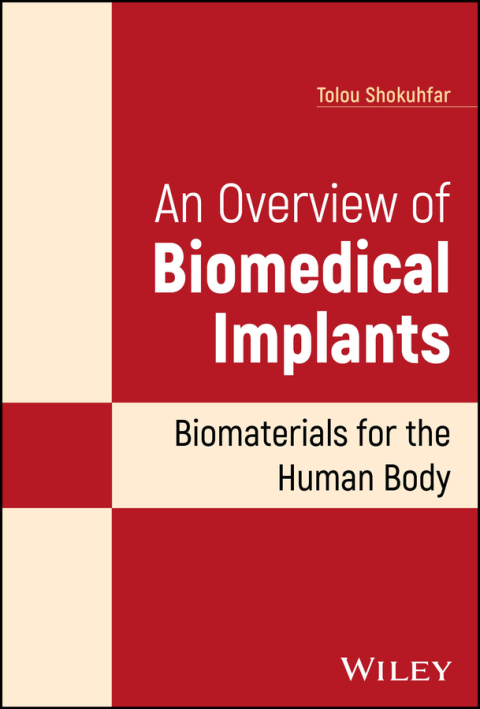 Cover image for book An Overview of Biomedical Implants
