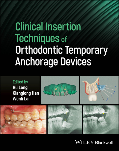 Cover image for book Clinical Insertion Techniques of Orthodontic Temporary Anchorage Devices