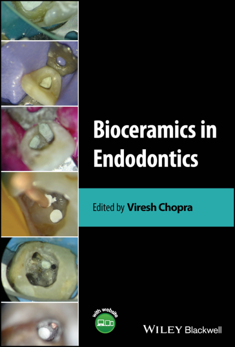 Cover image for book Bioceramics in Endodontics
