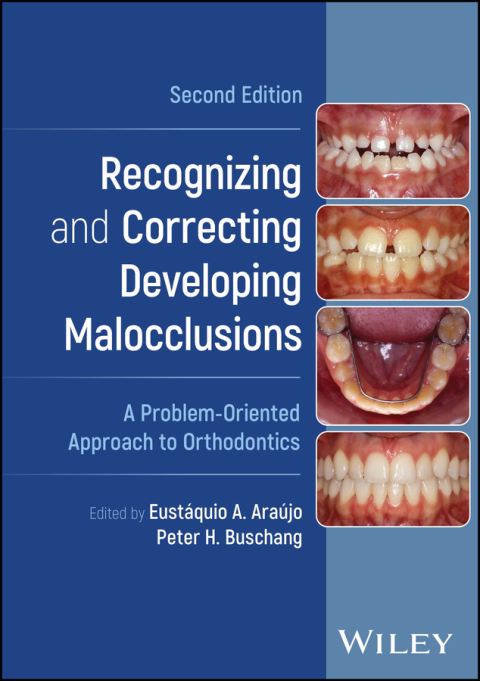 Cover image for book Recognizing and Correcting Developing Malocclusions