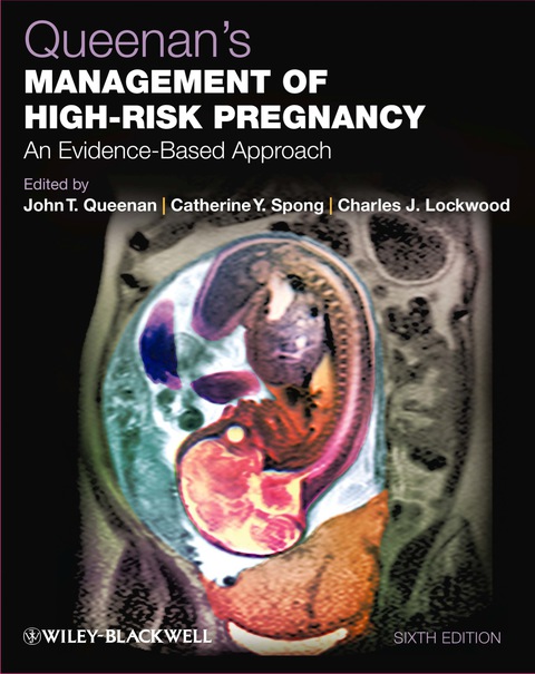 Cover image for book Queenan's Management of High-Risk Pregnancy: An Evidence-Based Approach