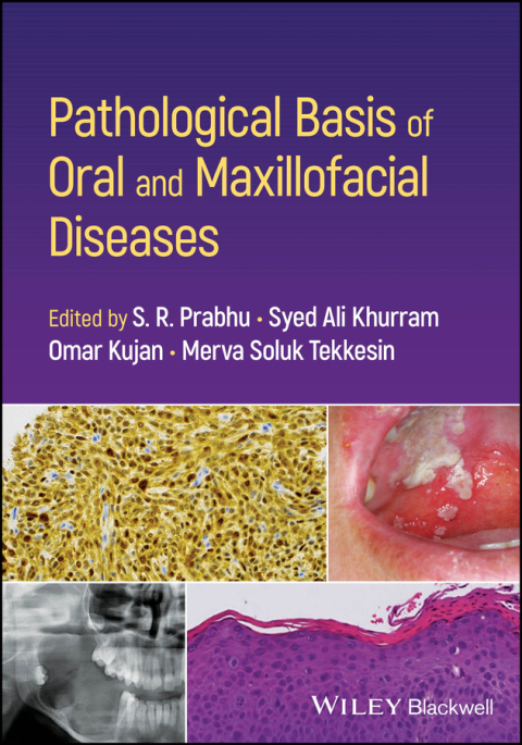 Cover image for book Pathological Basis of Oral and Maxillofacial Diseases