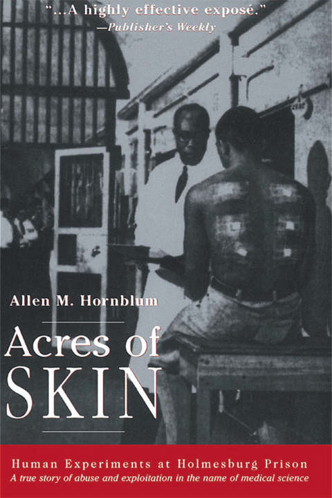 Cover image for book Acres of Skin