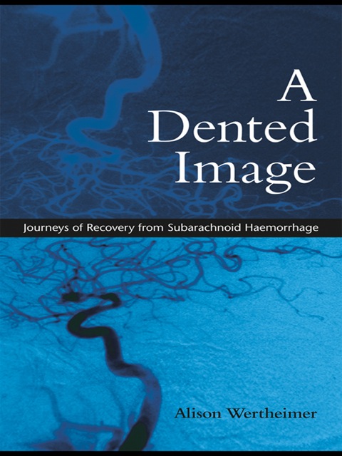 Cover image for book A Dented Image
