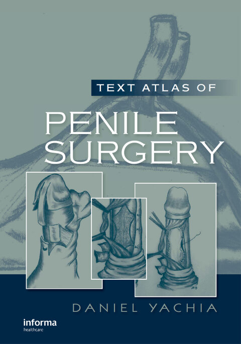 Cover image for book Text Atlas of Penile Surgery