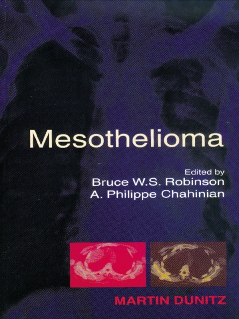 Cover image for book Mesothelioma