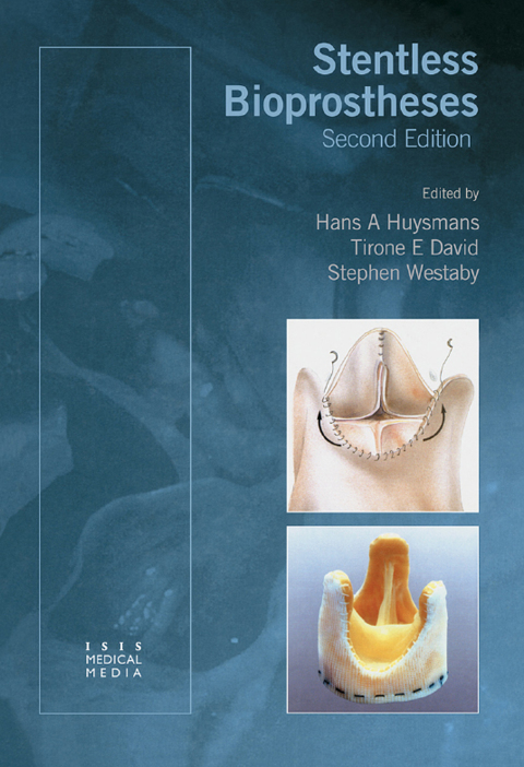 Cover image for book Stentless Bioprostheses