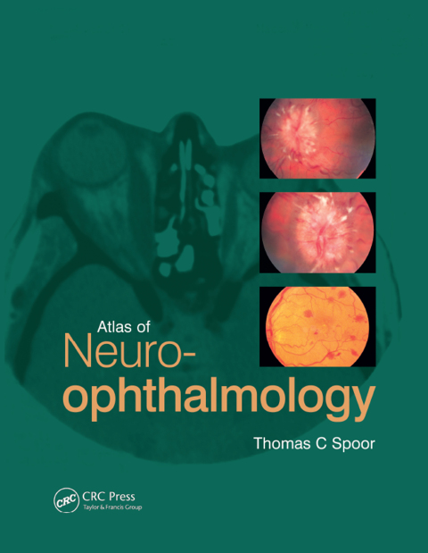 Cover image for book Atlas of Neuro-ophthalmology
