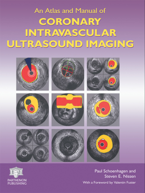 Cover image for book An Atlas and Manual of Coronary Intravascular Ultrasound Imaging