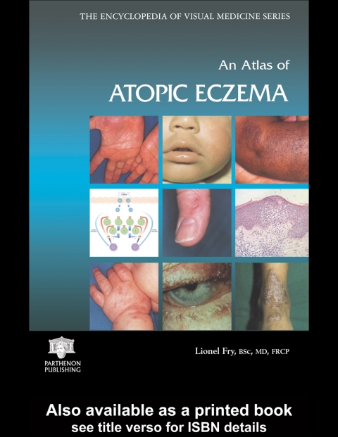An Atlas of Atopic Eczema 
