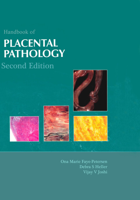 Cover image for book Handbook of Placental Pathology