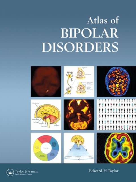 Atlas of Bipolar Disorders 