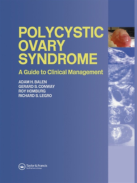 Cover image for book Polycystic Ovary Syndrome