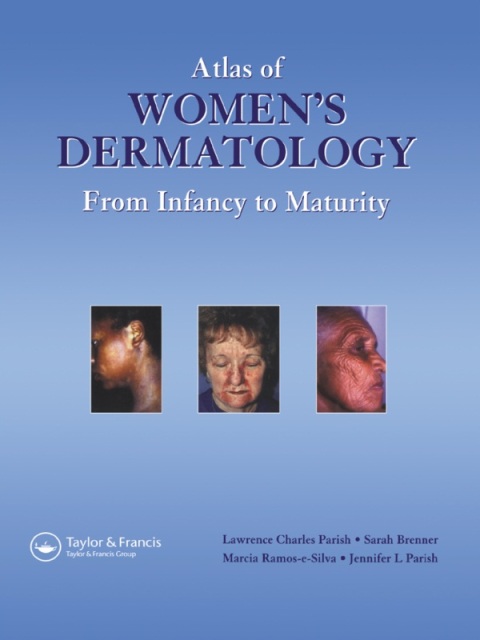 Cover image for book Atlas of Women's Dermatology
