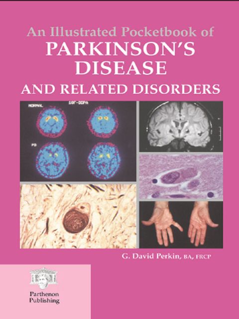 Cover image for book An Illustrated Pocketbook of Parkinson's Disease and Related Disorders