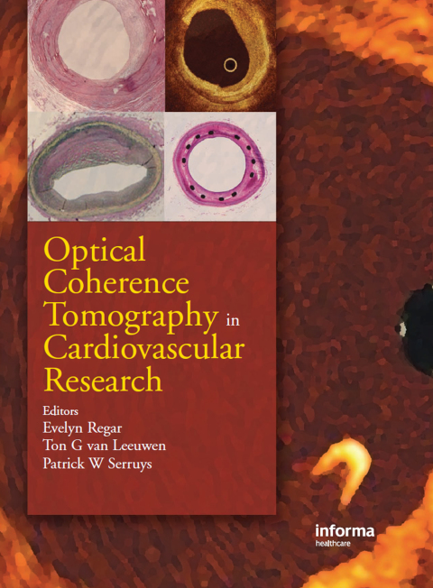 Cover image for book Optical Coherence Tomography in Cardiovascular Research