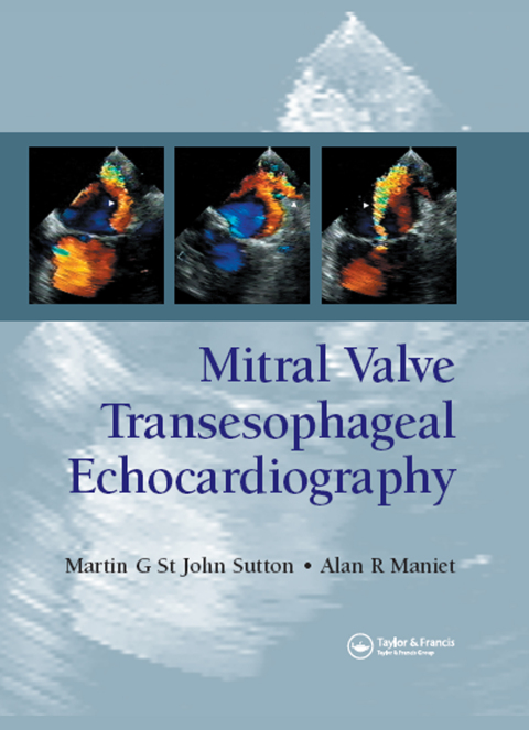 Cover image for book Mitral Valve Transesophageal Echocardiography
