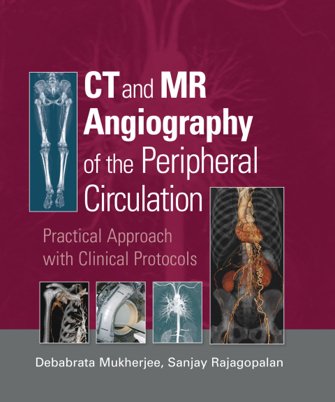 Cover image for book CT and MR Angiography of the Peripheral Circulation