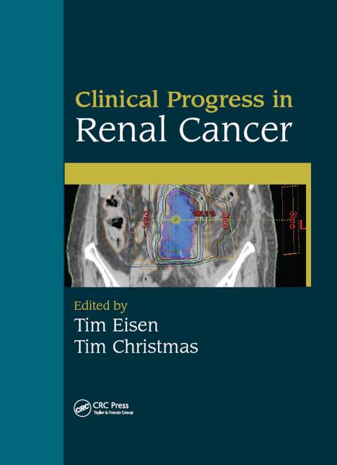 Cover image for book Clinical Progress in Renal Cancer