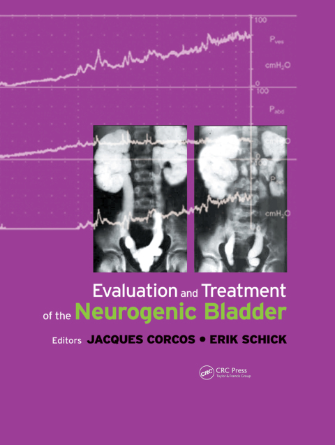 Cover image for book Evaluation and Treatment of the Neurogenic Bladder