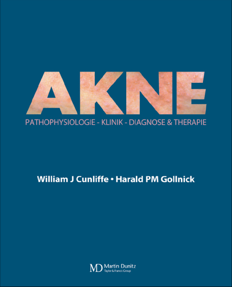 Cover image for book Acne
