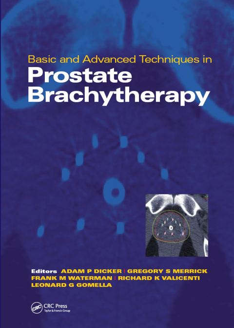 Cover image for book Basic and Advanced Techniques in Prostate Brachytherapy