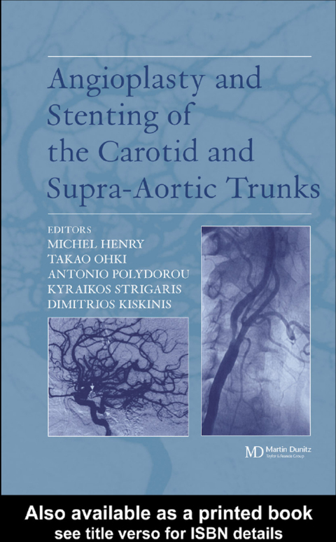 Cover image for book Angioplasty and Stenting of Carotid and Supra-aortic Trunks