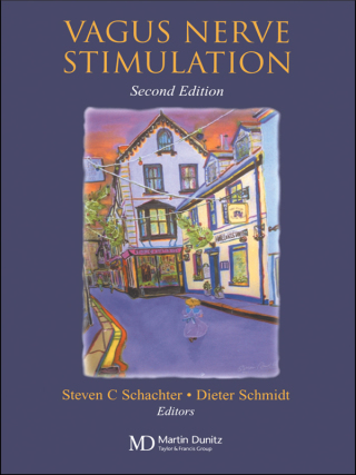 Vagus Nerve Stimulation