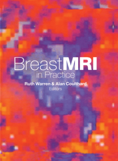 Cover image for book Breast MRI in Practice