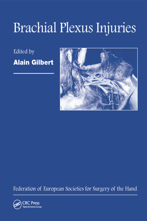 Cover image for book Brachial Plexus Injuries