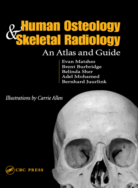 Cover image for book Human Osteology and Skeletal Radiology