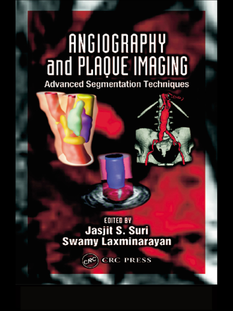 Cover image for book Angiography and Plaque Imaging