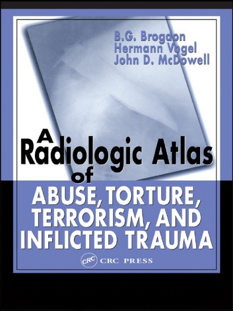 Cover image for book A Radiologic Atlas of Abuse, Torture, Terrorism, and Inflicted Trauma