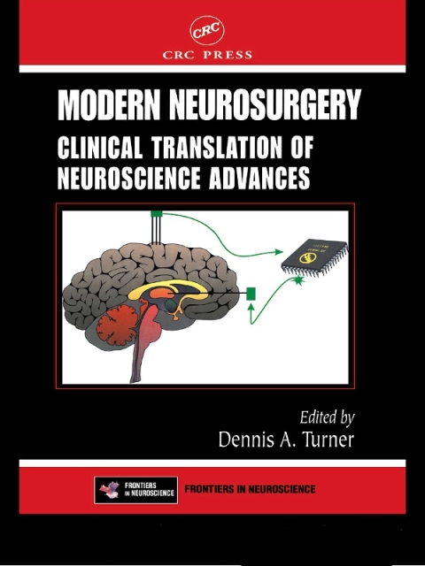 Cover image for book Modern Neurosurgery
