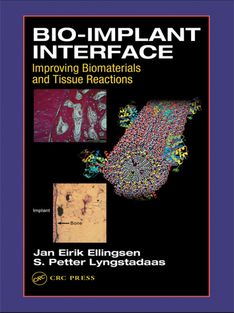 Cover image for book Bio-Implant Interface