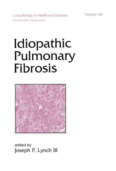 Cover image for book Idiopathic Pulmonary Fibrosis