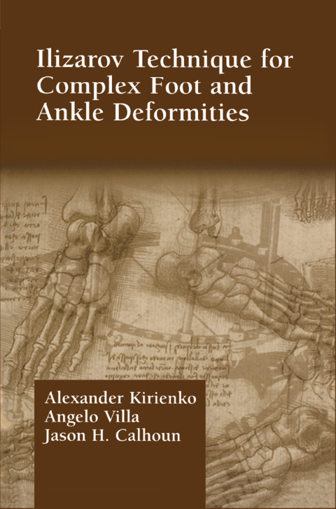 Cover image for book Ilizarov Technique for Complex Foot and Ankle Deformities