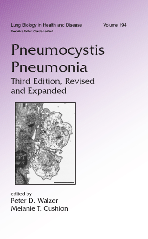 Cover image for book Pneumocystis Pneumonia