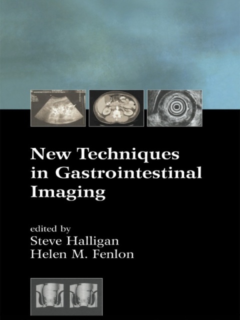 Cover image for book New Techniques in Gastrointestinal Imaging