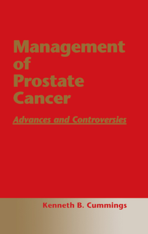Cover image for book Management of Prostate Cancer