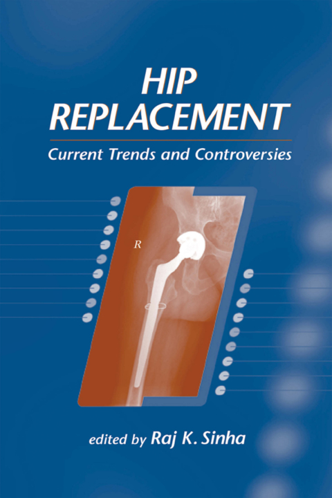 Cover image for book Hip Replacement