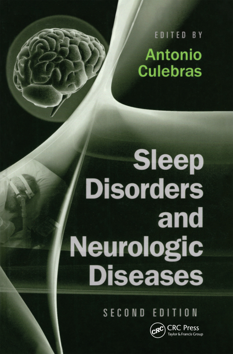 Cover image for book Sleep Disorders and Neurologic Diseases
