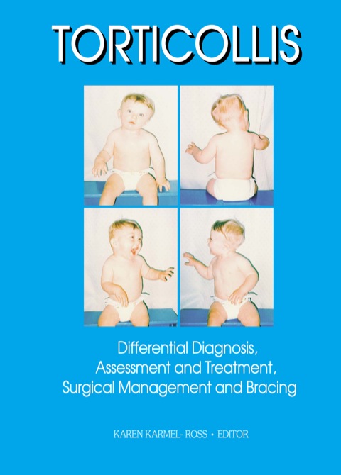 Cover image for book Torticollis