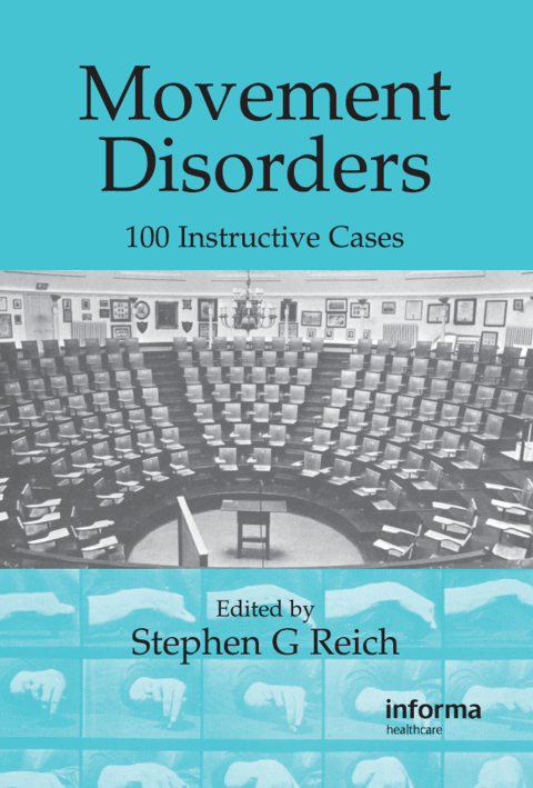 Cover image for book Movement Disorders
